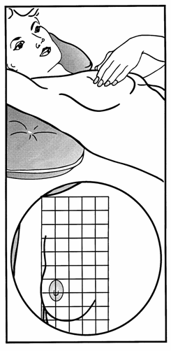 augmentace10