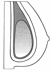 augmentace6