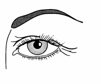 blefaroplastika1