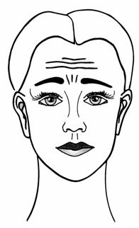 browlift1