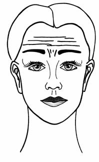 browlift2