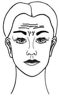browlift3
