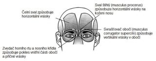 browlift9