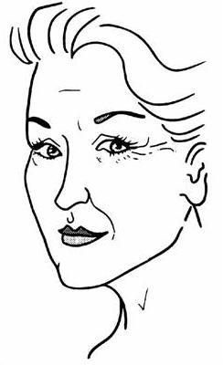 facelift1