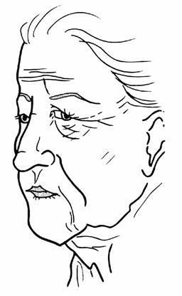facelift3