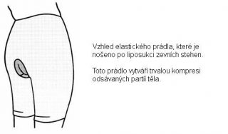 liposukce7
