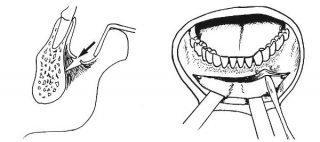 profiloplastika1
