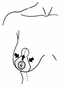 redukce10