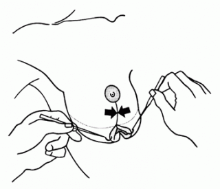 redukce11