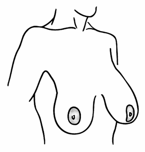 redukce8