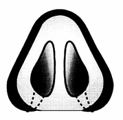 rhinoplastika11