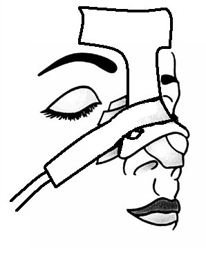 rhinoplastika14