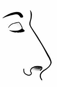 rhinoplastika15