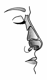 rhinoplastika16