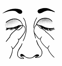 rhinoplastika17