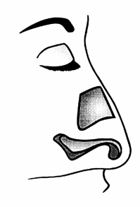 rhinoplastika9
