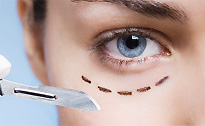 https://www.plasticka-chirurgie-dvorak.cz/wp-content/uploads/2016/10/page3_img2.jpg